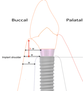 The Implant Supracrestal Complex