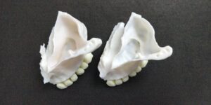 3D printing of bone
